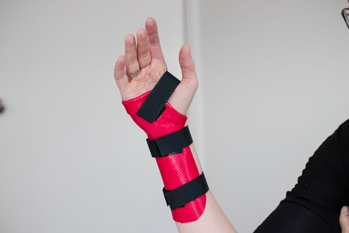 A custom-fitted wrist splint made by Restore Hand Therapy